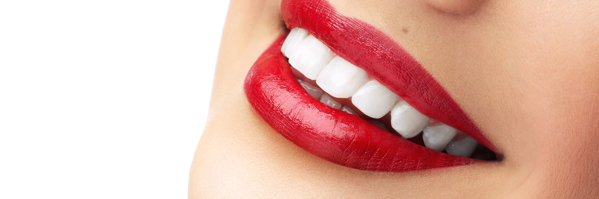 Teeth whitening Special offer South Croydon